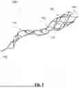 Fig. 04 - SYSTEMS AND METHODS OF REMOVING CHALLENGING CLOTS AND RESTORING PERFUSION TO A VESSEL