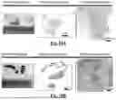 Fig. 15 - SYSTEMS AND METHODS OF REMOVING CHALLENGING CLOTS AND RESTORING PERFUSION TO A VESSEL