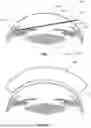 Fig. 07 - Systems and methods for treating patients with closed-angle or narrow-angle glaucoma using an excimer laser unit