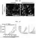 Fig. 22 - METHOD FOR PRODUCING CHIMERIC ANTIGEN RECEPTOR-MACROPHAGES AND USE OF SAME CELLS
