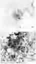 Fig. 09 - USE OF PLANT-DERIVED EXOSOMES FOR INDUCING DIFFERENTIATION OF STEM CELL SOURCES INTO CARTILAGE AND BONE CELLS