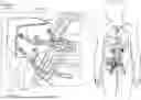 Fig. 01 - Hemofiltration device and methods of use thereof
