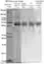 Fig. 01 - DEVELOPMENT AND APPLICATION OF COMPLEMENT INHIBITOR