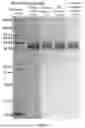 Fig. 02 - DEVELOPMENT AND APPLICATION OF COMPLEMENT INHIBITOR