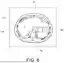 Fig. 07 - MEDICAL IMAGE PROCESSING APPARATUS