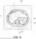 Fig. 09 - MEDICAL IMAGE PROCESSING APPARATUS