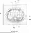 Fig. 12 - MEDICAL IMAGE PROCESSING APPARATUS