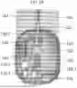 Fig. 06 - SYSTEM FOR ADVANCED PHYSICIAN TRAINING AND PATIENT SPECIFIC REHEARSALS