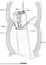 Fig. 167 - Manifold for a multiple viewing elements endoscope