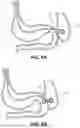 Fig. 07 - SYSTEMS, DEVICES, AND METHODS FOR ENDOSCOPE OR LAPAROSCOPIC MAGNETIC NAVIGATION