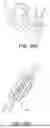 Fig. 33 - SYSTEMS, DEVICES, AND METHODS FOR ENDOSCOPE OR LAPAROSCOPIC MAGNETIC NAVIGATION