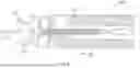Fig. 09 - INTEGRATED EXPANDABLE ACCESS FOR MEDICAL DEVICE INTRODUCER