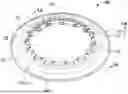 Fig. 01 - Ostomy appliance for providing customized and localized convex support