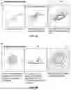 Fig. 06 - Ostomy appliance for providing customized and localized convex support