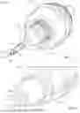 Fig. 02 - DEVICES AND METHODS FOR IMPROVED FOLLOWABILITY IN LASER-BASED OCULAR PROCEDURES
