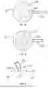 Fig. 09 - DEVICES AND METHODS FOR WOUND TREATMENT