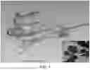 Fig. 02 - METHOD FOR THE TREATMENT OF AN AUDITORY DISEASE OR CONDITION