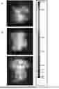Fig. 01 - DELIVERY SYSTEM FOR USE IN MEDICINE