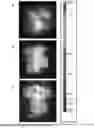 Fig. 08 - DELIVERY SYSTEM FOR USE IN MEDICINE