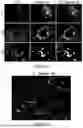 Fig. 06 - ENGINEERED EXOSOMES TO DETECT AND DEPLETE PRO-TUMORIGENIC MACROPHAGES