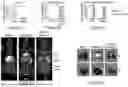 Fig. 07 - ENGINEERED EXOSOMES TO DETECT AND DEPLETE PRO-TUMORIGENIC MACROPHAGES