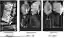 Fig. 22 - ENGINEERED EXOSOMES TO DETECT AND DEPLETE PRO-TUMORIGENIC MACROPHAGES