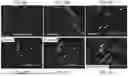 Fig. 37 - ENGINEERED EXOSOMES TO DETECT AND DEPLETE PRO-TUMORIGENIC MACROPHAGES