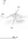 Fig. 10 - FASTENING OF A HIGH-VOLTAGE DUAL RAIL