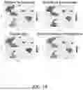 Fig. 07 - CORTICAL NEURAL PROGENITOR CELLS FROM IPSCS