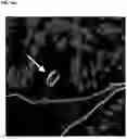 Fig. 22 - COMPOSITIONS AND METHODS FOR MODULATING GROWTH OF A GENETICALLY MODIFIED GUT BACTERIAL CELL