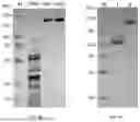 Fig. 07 - MODIFIED L-ASPARAGINASE