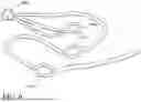 Fig. 07 - SAFE METAL FREE AND HOOKLESS WINCH ROPE
