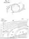 Fig. 02 - Diffractive trifocal lens
