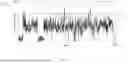 Fig. 09 - SYSTEMS AND METHODS FOR IDENTIFYING SEGMENTS OF MUSIC HAVING CHARACTERISTICS SUITABLE FOR INDUCING AUTONOMIC PHYSIOLOGICAL RESPONSES