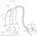 Fig. 01 - A METHOD FOR PROVIDING AN EARLY WARNING SCORE BY MEANS OF A WEARABLE SYSTEM COMPRISING AN EAR-WORN DEVICE