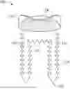 Fig. 01 - BICEP TENODESIS ATHROSCOPIC STAPLE
