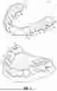 Fig. 02 - ORTHODONTIC APPLIANCES, ATTACHMENTS, SYSTEMS INCLUDING APPLIANCES AND ATTACHMENTS, AND METHODS FOR ORTHODONTIC APPLIANCE AND ATTACHMENT FABRICATION