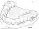 Fig. 03 - ORTHODONTIC APPLIANCES, ATTACHMENTS, SYSTEMS INCLUDING APPLIANCES AND ATTACHMENTS, AND METHODS FOR ORTHODONTIC APPLIANCE AND ATTACHMENT FABRICATION