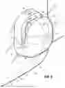 Fig. 07 - ORTHODONTIC APPLIANCES, ATTACHMENTS, SYSTEMS INCLUDING APPLIANCES AND ATTACHMENTS, AND METHODS FOR ORTHODONTIC APPLIANCE AND ATTACHMENT FABRICATION
