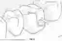 Fig. 12 - ORTHODONTIC APPLIANCES, ATTACHMENTS, SYSTEMS INCLUDING APPLIANCES AND ATTACHMENTS, AND METHODS FOR ORTHODONTIC APPLIANCE AND ATTACHMENT FABRICATION