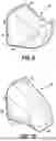 Fig. 13 - ORTHODONTIC APPLIANCES, ATTACHMENTS, SYSTEMS INCLUDING APPLIANCES AND ATTACHMENTS, AND METHODS FOR ORTHODONTIC APPLIANCE AND ATTACHMENT FABRICATION