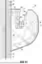 Fig. 16 - ORTHODONTIC APPLIANCES, ATTACHMENTS, SYSTEMS INCLUDING APPLIANCES AND ATTACHMENTS, AND METHODS FOR ORTHODONTIC APPLIANCE AND ATTACHMENT FABRICATION