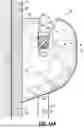 Fig. 18 - ORTHODONTIC APPLIANCES, ATTACHMENTS, SYSTEMS INCLUDING APPLIANCES AND ATTACHMENTS, AND METHODS FOR ORTHODONTIC APPLIANCE AND ATTACHMENT FABRICATION