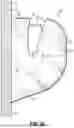 Fig. 23 - ORTHODONTIC APPLIANCES, ATTACHMENTS, SYSTEMS INCLUDING APPLIANCES AND ATTACHMENTS, AND METHODS FOR ORTHODONTIC APPLIANCE AND ATTACHMENT FABRICATION
