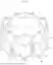 Fig. 10 - Covering and assembly method for transcatheter valve