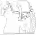 Fig. 01 - DEVICES, SYSTEMS, AND METHODS FOR ARTIFICIAL CHORDAE TENDINEAE