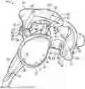 Fig. 01 - GLENOID REPLACEMENT SYSTEM AND METHODS OF IMPLANTING SAID GLENOID REPLACEMENT