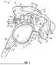 Fig. 03 - GLENOID REPLACEMENT SYSTEM AND METHODS OF IMPLANTING SAID GLENOID REPLACEMENT