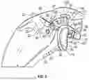 Fig. 04 - GLENOID REPLACEMENT SYSTEM AND METHODS OF IMPLANTING SAID GLENOID REPLACEMENT