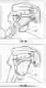 Fig. 09 - GLENOID REPLACEMENT SYSTEM AND METHODS OF IMPLANTING SAID GLENOID REPLACEMENT